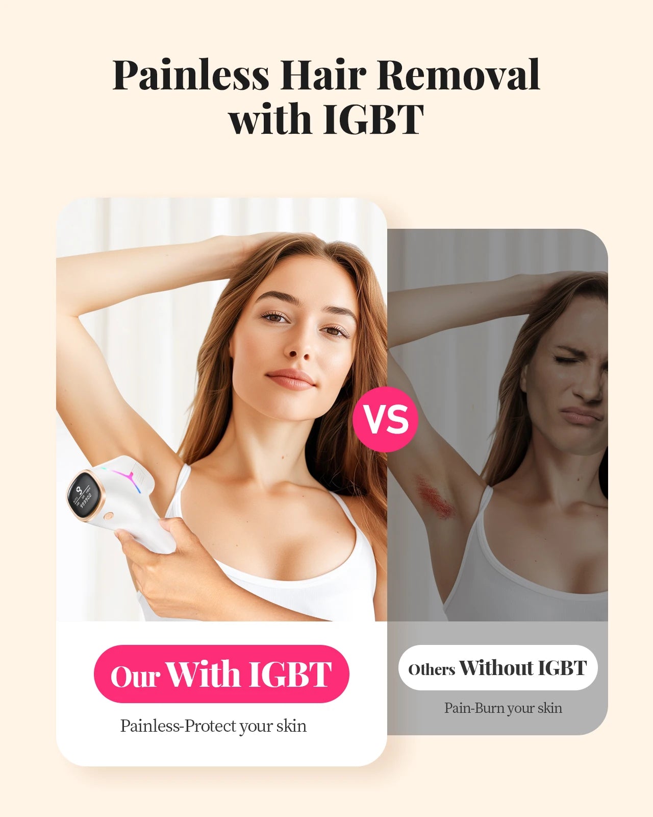 Epilator til hårfjerning. IPL Laser